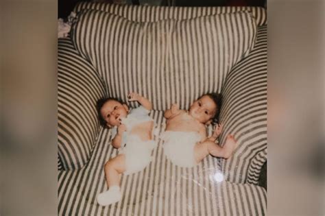 gabby garcia conjoined twin|Former Conjoined Twin Grows up To Become an Influencer Who。